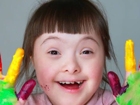 Zihinsel Yetersizliği Olan Bireyler İçin Destek Eğitim Prg.